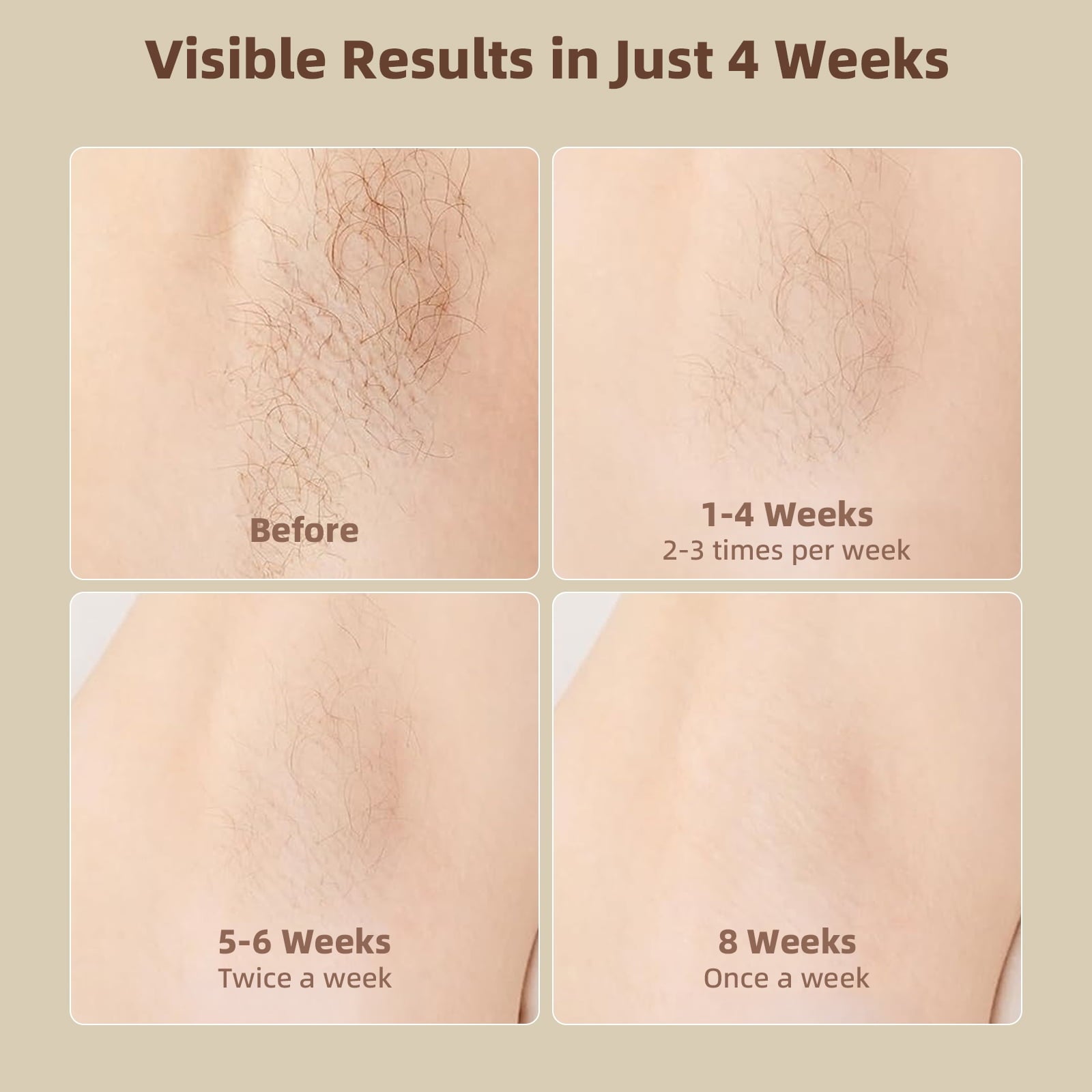 Laser Hair Removal for Women & Men, 999,999 Flashes Hair Remover Device for Armpits Legs Arms Bikini Line, White